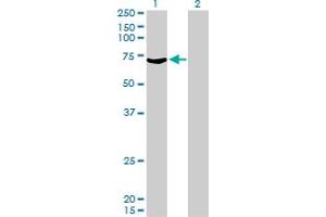 Western Blot analysis of MYLK2 expression in transfected 293T cell line by MYLK2 monoclonal antibody (M01), clone 2G1.