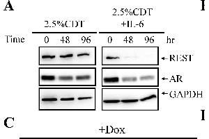 Image no. 38 for anti-Glyceraldehyde-3-Phosphate Dehydrogenase (GAPDH) (Center) antibody (ABIN2857072)
