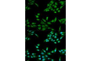 Image no. 2 for anti-Mismatch Repair Protein 2 (MSH2) antibody (ABIN3021477)
