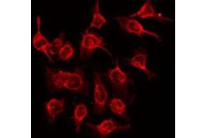 Image no. 1 for anti-NDRG Family Member 3 (NDRG3) (Internal Region) antibody (ABIN6259169)