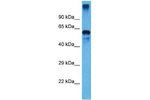 Image no. 2 for anti-Prolyl 4-Hydroxylase, beta Polypeptide (P4HB) (C-Term) antibody (ABIN2783246)