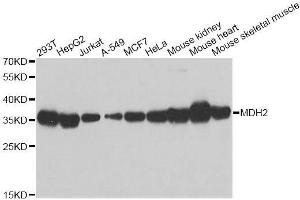 Image no. 1 for anti-Malate Dehydrogenase 2, NAD (Mitochondrial) (MDH2) antibody (ABIN6143667)