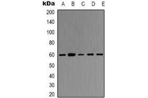 Image no. 2 for anti-TNF Receptor-Associated Factor 6 (TRAF6) antibody (ABIN2957781)