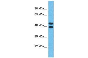 Image no. 1 for anti-Olfactory Receptor, Family 4, Subfamily Q, Member 3 (OR4Q3) (C-Term) antibody (ABIN2791740)