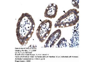 Image no. 2 for anti-Early Growth Response 2 (EGR2) (C-Term) antibody (ABIN2792631)