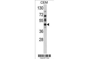 Image no. 2 for anti-Ubiquitin Specific Peptidase 12 (USP12) (AA 5-35), (N-Term) antibody (ABIN388898)