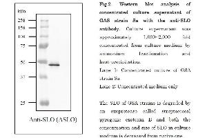 Image no. 3 for anti-Streptolysin O (SLO) (full length) antibody (ABIN2452132)