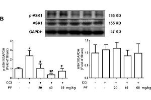 Image no. 1 for anti-Mitogen-Activated Protein Kinase Kinase Kinase 5 (MAP3K5) (pThr845) antibody (ABIN683128)
