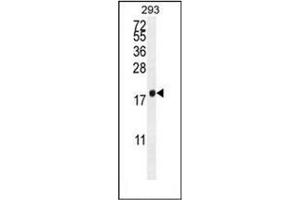 Image no. 3 for anti-C1QTNF9B Antisense RNA 1 (C1QTNF9B-AS1) (AA 21-50), (Middle Region) antibody (ABIN954054)