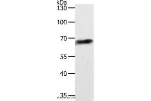 Image no. 1 for anti-ATP-Binding Cassette, Sub-Family D (Ald), Member 4 (ABCD4) antibody (ABIN2426497)
