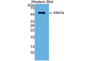 Image no. 1 for anti-Interferon Regulatory Factor 3 (IRF3) (AA 1-406) antibody (ABIN1868750)