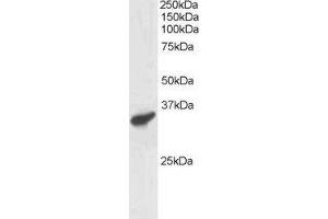 Image no. 1 for anti-Polycomb Group Ring Finger 3 (PCGF3) (C-Term) antibody (ABIN184926)