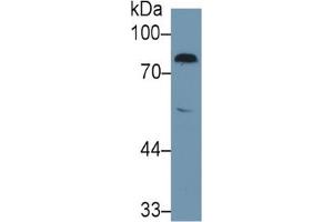Image no. 4 for Coagulation Factor II (thrombin) (F2) ELISA Kit (ABIN6574219)