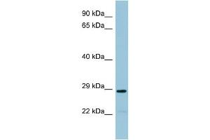Image no. 1 for anti-N-Acetyltransferase 8B (GCN5-Related, Putative, Gene/pseudogene) (NAT8B) (Middle Region) antibody (ABIN2776905)