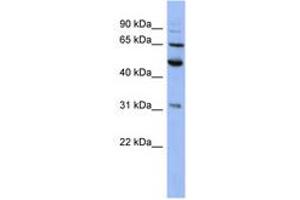 Image no. 1 for anti-Proteasome (Prosome, Macropain) 26S Subunit, Non-ATPase, 3 (PSMD3) (AA 107-156) antibody (ABIN6744086)