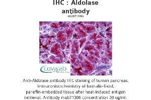 Image no. 1 for anti-Aldolase (ALD) antibody (ABIN1724411)