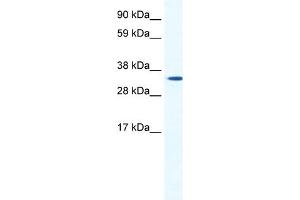 Image no. 1 for anti-Homeobox B1 (HOXB1) (N-Term) antibody (ABIN2779852)
