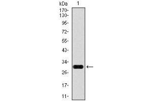 Image no. 6 for anti-Glypican 3 (GPC3) antibody (ABIN969523)