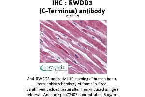 Image no. 2 for anti-RWD Domain Containing 3 (RWDD3) (C-Term) antibody (ABIN1738978)