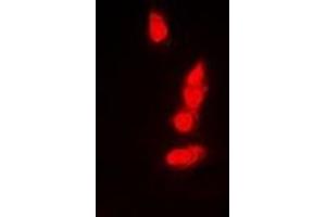 Image no. 1 for anti-Proteasome (Prosome, Macropain) Subunit, beta Type, 8 (Large Multifunctional Peptidase 7) (PSMB8) antibody (ABIN2966946)
