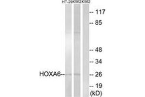 Image no. 1 for anti-Homeobox A6 (HOXA6) (AA 101-150) antibody (ABIN1534982)