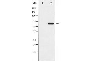 Image no. 4 for anti-Ezrin (EZR) (pTyr353) antibody (ABIN6256714)
