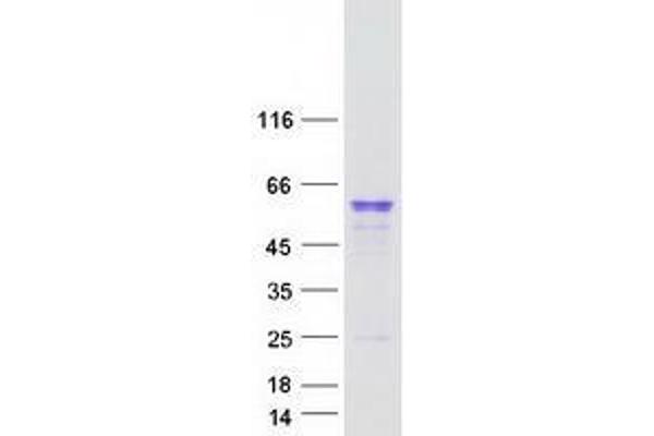UGT2A1 Protein (Myc-DYKDDDDK Tag)