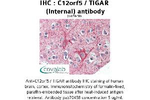 Image no. 1 for anti-TP53 induced glycolysis regulatory phosphatase (TIGAR) (Internal Region) antibody (ABIN1732470)