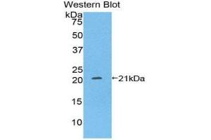 Image no. 1 for anti-Pleckstrin Homology-Like Domain, Family A, Member 2 (PHLDA2) (AA 1-152) antibody (ABIN1860205)