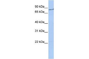 Image no. 3 for anti-Coagulation Factor II (thrombin) (F2) (Middle Region) antibody (ABIN2776976)