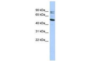 Image no. 1 for anti-Calpain 10 (CAPN10) (N-Term) antibody (ABIN6741135)
