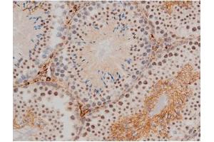 Image no. 7 for anti-Jun D Proto-Oncogene (JUND) (pSer255) antibody (ABIN6255135)