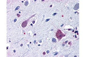 Image no. 2 for anti-Serotonin Receptor 2B (HTR2B) (Cytoplasmic Domain) antibody (ABIN1048267)
