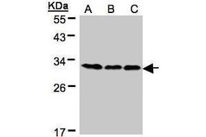Image no. 4 for anti-B-Cell Receptor-Associated Protein 31 (BCAP31) (Center) antibody (ABIN2855244)