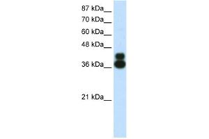 Image no. 1 for anti-Forkhead Box J1 (FOXJ1) (N-Term) antibody (ABIN2780365)