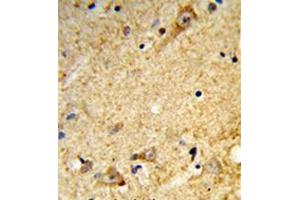 Image no. 1 for anti-Tricellulin (MARVELD2) (AA 393-423), (C-Term) antibody (ABIN955328)