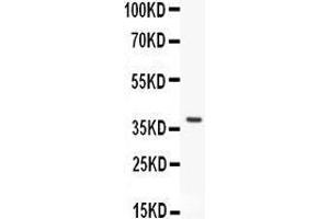 Image no. 2 for anti-Forkhead Box O3 (FOXO3) (AA 471-673) antibody (ABIN3042404)