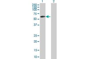 Western Blot analysis of ZBTB6 expression in transfected 293T cell line by ZBTB6 MaxPab polyclonal antibody.