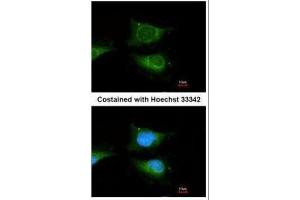 ICC/IF Image Immunofluorescence analysis of methanol-fixed HeLa, using GBA, antibody at 1:100 dilution.