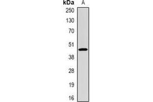 Image no. 2 for anti-Complement Factor H-Related 1 (CFHR1) (full length) antibody (ABIN6043314)