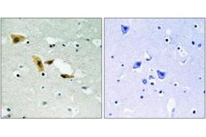 Image no. 2 for anti-Aprataxin and PNKP Like Factor (APLF) (AA 82-131) antibody (ABIN1533153)