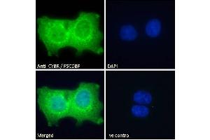 Image no. 4 for anti-Cytohesin 1 Interacting Protein (CYTIP) (N-Term) antibody (ABIN184711)