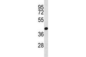 PRMT6 antibody western blot analysis in NCI-H460 lysate
