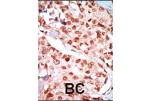 Immunohistochemistry (IHC) image for anti-Protein Kinase, AMP-Activated, gamma 3 Non-Catalytic Subunit (PRKAG3) (Center) antibody (ABIN2159102)