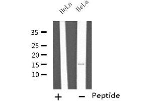 Image no. 1 for anti-Interleukin 4 (IL4) antibody (ABIN6257292)