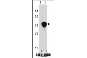 Image no. 3 for anti-Transaldolase 1 (TALDO1) (Center) antibody (ABIN2504269)