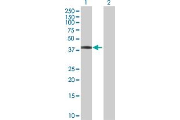 anti-SERTA Domain Containing 2 (SERTAD2) (AA 1-314) antibody