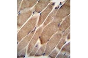 Image no. 1 for anti-Engulfment and Cell Motility 2 (ELMO2) (AA 330-357), (Middle Region) antibody (ABIN952066)
