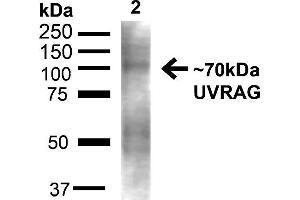 Image no. 3 for anti-UV Radiation Resistance Associated Gene (UVRAG) (C-Term) antibody (PerCP) (ABIN2868807)
