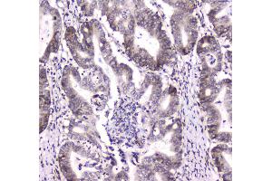 Image no. 2 for anti-DiGeorge Syndrome Critical Region Gene 8 (DGCR8) (AA 561-762) antibody (ABIN5692841)